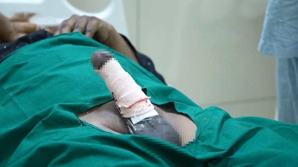 What to Expect After Penile Implant Surgery: Recovery & Healing Advice