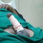 What to Expect After Penile Implant Surgery: Recovery & Healing Advice